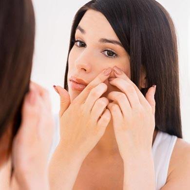 Acne Rosacea: di cosa si tratta e come curarla