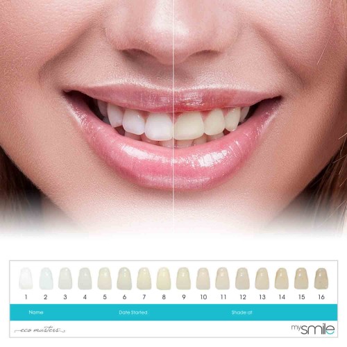 Eco Masters mySmile Teeth Whitening Gels - 8 mySmile Refill Whitening Gels