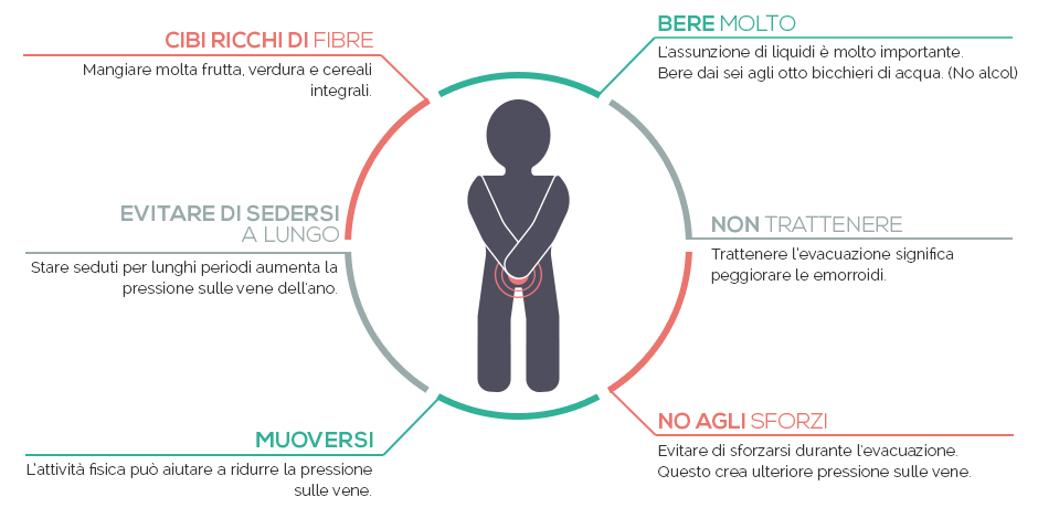 emorroidi come prevenirle