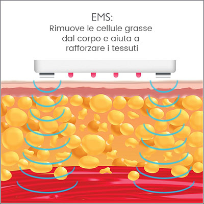 silk lipo