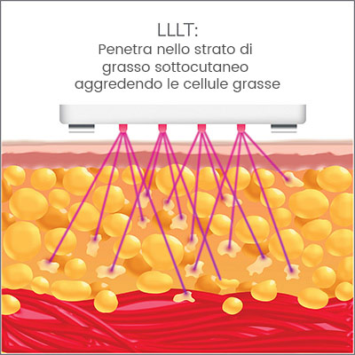 silk lipo