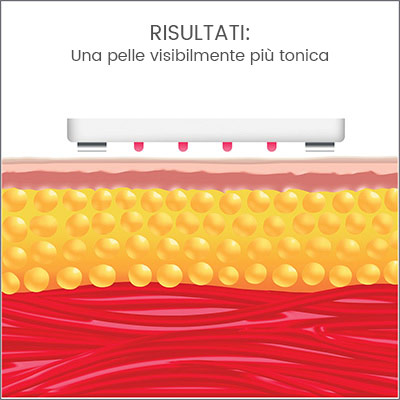 silk lipo